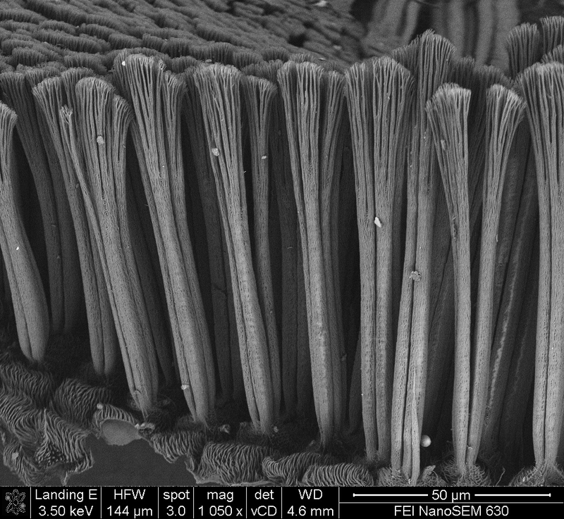 Los pelos de queratina, al microscopio electrónico: Foto: Universidad de Idaho